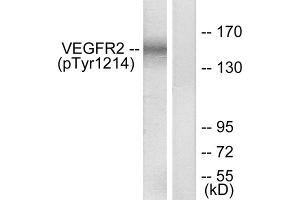Western blot analysis of extracts from HepG2 cells, treated with Na3VO4 (0. (VEGFR2/CD309 anticorps  (pTyr1214))