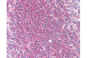 Anti-MCL1 antibody IHC of human spleen. (MCL-1 anticorps)
