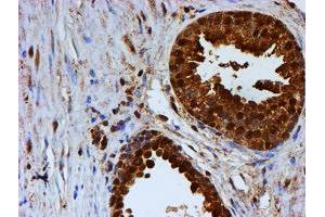 Image no. 5 for anti-Proteasome (Prosome, Macropain) Subunit, beta Type, 9 (Large Multifunctional Peptidase 2) (PSMB9) (AA 21-219) antibody (ABIN1491194)