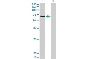 Western Blot analysis of CACNB1 expression in transfected 293T cell line by CACNB1 monoclonal antibody (M01), clone 1G6.
