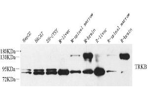 Western Blot analysis of various samples using NTRK2 Polyclonal Antibody at dilution of 1:1000. (TRKB anticorps)
