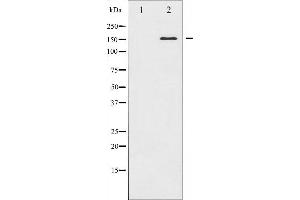 Western blot analysis of ASK1 expression in MDA-MB-435 whole cell lysates,The lane on the left is treated with the antigen-specific peptide.