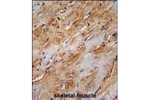 G8b (M1LC3B)-T93/Y99 Antibody (Center) 1802e immunohistochemistry analysis in forlin fixed and paraffin embedded hun skeletal muscle followed by peroxidase conjugation of the secondary antibody and DAB staining. (APG8b (AA 74-106) anticorps)