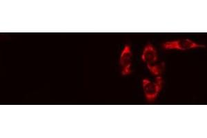 ABIN6275097 staining HeLa cells by IF/ICC. (RNF144B anticorps  (Internal Region))