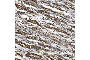 IHC analysis of MitoNEET/CISD1 using anti-MitoNEET/CISD1 antibody (ABIN7601089).