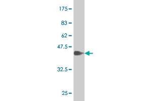 Western Blot detection against Immunogen (37. (SOX9 anticorps  (AA 400-509))