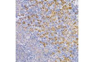 Immunohistochemistry of paraffin-embedded mouse brain using Symmetric DiMethyl-Histone H4-R3 Rabbit pAb (ABIN3017488, ABIN3017489, ABIN3017490, ABIN1680265 and ABIN6220116) at dilution of 1:100 (40x lens).