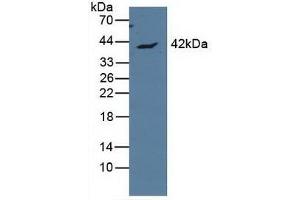 Detection of APOL1 in Human MCF7 Cells using Polyclonal Antibody to Apolipoprotein L (APOL1) (APOL1 anticorps  (AA 1-238))