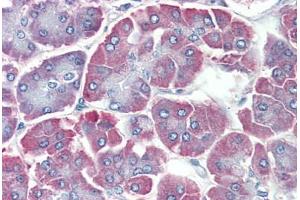 Human Pancreas: Formalin-Fixed, Paraffin-Embedded (FFPE) (BACE2 anticorps  (C-Term))