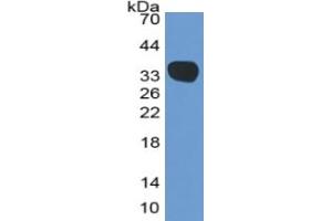 WB of Protein Standard: different control antibodies against Highly purified E.