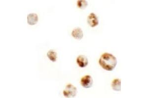 Immunocytochemistry of AFAP1L in A549 cells with AFAP1L Antibody at 5 µg/ml.