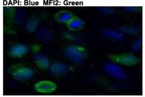 Immunofluorescent staining of HeLa cells with MFI2 polyclonal antibody  at 1:50 dilution. (MFI2 anticorps  (C-Term))