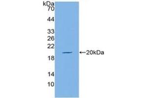 WB of Protein Standard: different control antibodies against Highly purified E. (MUC5AC Kit ELISA)