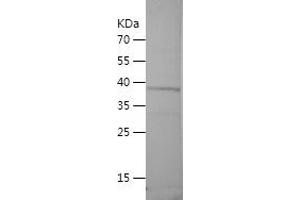Western Blotting (WB) image for Ficolin (Collagen/fibrinogen Domain Containing) 3 (Hakata Antigen) (FCN3) (AA 21-185) protein (His-IF2DI Tag) (ABIN7122966)