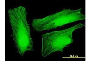 Immunofluorescence of purified MaxPab antibody to UXT on HeLa cell.