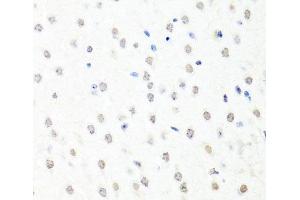 Immunohistochemistry of paraffin-embedded Mouse brain using CHRAC1 Polyclonal Antibody at dilution of 1:100 (40x lens). (CHRAC1 anticorps)
