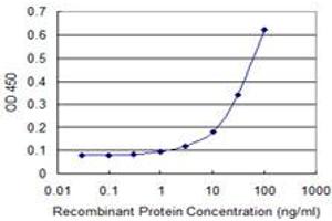 Image no. 4 for anti-Aldehyde Dehydrogenase 4 Family, Member A1 (ALDH4A1) (AA 1-564) antibody (ABIN599053) (ALDH4A1 anticorps  (AA 1-564))