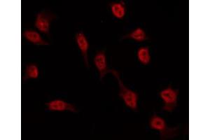 ABIN6274552 staining Hela by IF/ICC. (ASF1A anticorps  (Internal Region))