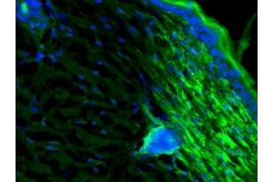 C57BL/6 mice were shaved, treated with nair to remove residual hair and painted with IFNg.