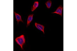 ABIN6262005 and ABIN6273249 staining Hela by IF/ICC. (GMFG anticorps  (Internal Region))