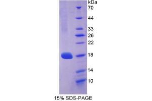 SDS-PAGE analysis of Mouse COL3A1 Protein. (COL3A1 Protéine)