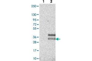 Western blot analysis of Lane 1: Negative control (vector only transfected HEK293T lysate). (CD99L2 anticorps)
