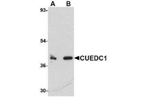 Western blot analysis of CUEDC1 in rat liver tissue lysate with AP30261PU-N CUEDC1 antibody at (A) 0. (CUEDC1 anticorps  (C-Term))