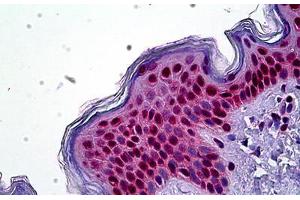 Human Skin: Formalin-Fixed, Paraffin-Embedded (FFPE) (SETD8 anticorps  (N-Term))