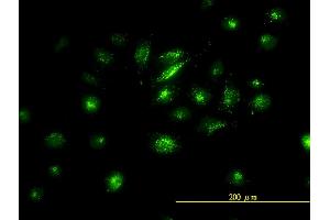 Immunofluorescence of monoclonal antibody to FOSL2 on HeLa cell.