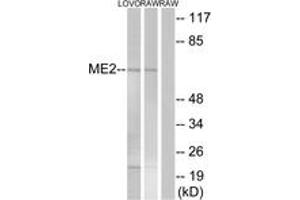 Western blot analysis of extracts from RAW264. (NAD-ME anticorps  (AA 201-250))