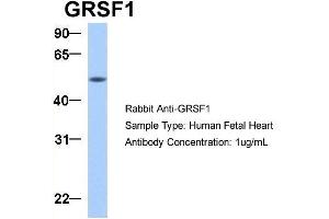 Host:  Rabbit  Target Name:  GRSF1  Sample Type:  Human Fetal Heart  Antibody Dilution:  1. (GRSF1 anticorps  (Middle Region))