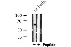 Western blot analysis of VGF  expression in Rat brain lysate (VGF anticorps  (Internal Region))