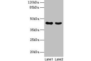 Western blot All lanes: MAS1L antibody at 2 μg/mL Lane 1: Colo320 whole cell lysate Lane 2: Hela whole cell lysate Secondary Goat polyclonal to rabbit IgG at 1/10000 dilution Predicted band size: 43 kDa Observed band size: 43 kDa (MAS1L anticorps  (AA 318-378))