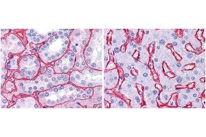 Anti collagen IV antibody (1:400, 45 min RT) showed strong staining in FFPE sections of human kidney (Left) with strong red staining observed in glomeruli and liver (Right) with strong staining in sinusoids.