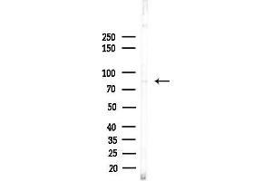 anti-Smoothened Homolog (Drosophila) (SMO) (N-Term) antibody