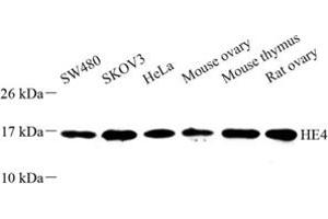Western blot analysis of HE4 (ABIN7076209) at dilution of 1: 500 (WFDC2 anticorps)