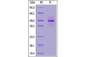 Biotinylated Human Syndecan-1, His,Avitag™ on  under reducing (R) condition.