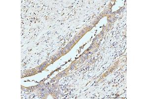 IHC analysis of GIT1 using anti-GIT1 antibody (ABIN7601683). (GIT1 anticorps  (AA 415-736))