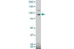 PDE6C polyclonal antibody (A01), Lot # 060116JC01 Western Blot analysis of PDE6C expression in HL-60 .
