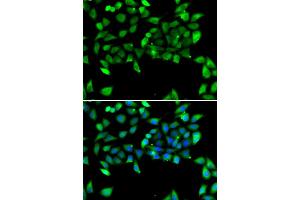 Immunofluorescence analysis of U20S cell using EIF3H antibody.