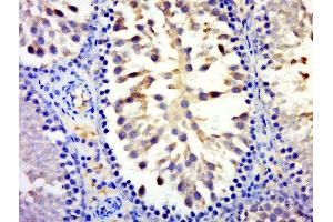 Paraformaldehyde-fixed, paraffin embedded rat testis tissue, Antigen retrieval by boiling in sodium citrate buffer(pH6) for 15min, Block endogenous peroxidase by 3% hydrogen peroxide for 30 minutes, Blocking buffer (normal goat serum) at 37°C for 20min, Antibody incubation with Rabbit Anti-MYCBPAP Polyclonal Antibody, Unconjugated  at 1:500 overnight at 4°C, followed by a conjugated secondary and DAB staining