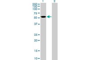 Western Blot analysis of ASL expression in transfected 293T cell line by ASL MaxPab polyclonal antibody. (ASL anticorps  (AA 1-464))