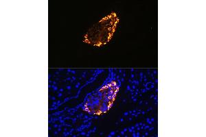 Immunofluorescence analysis of rat pancreas using Somatostatin (SST) Rabbit pAb (ABIN6133914, ABIN6148498, ABIN6148499 and ABIN6224956) at dilution of 1:100 (40x lens).