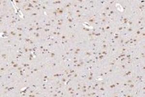Immunohistochemistry analysis of paraffin-embedded rat substantia nigra using TBXT (ABIN7075815) at dilution of 1: 3200