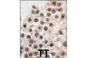 Formalin-fixed and paraffin-embedded human testis tissue reacted with ARID3B polyclonal antibody  , which was peroxidase-conjugated to the secondary antibody, followed by DAB staining. (ARID3B anticorps  (C-Term))