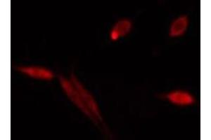 ABIN6275512 staining  HeLa cells by IF/ICC.