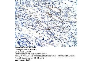 Rabbit Anti-NOL4 Antibody  Paraffin Embedded Tissue: Human Kidney Cellular Data: Epithelial cells of renal tubule Antibody Concentration: 4. (NOL4 anticorps  (N-Term))