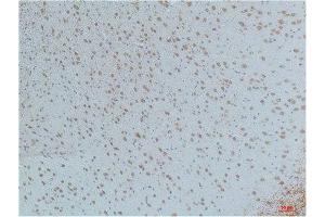 Immunohistochemistry (IHC) analysis of paraffin-embedded Mouse Brain Tissue using CaMKIIbeta/ gamma /delta (Phospho Thr287) Mouse Monoclonal Antibody diluted at 1:200. (CaMKIIbeta/gamma/delta anticorps  (pThr287))