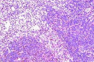 Immunohistochemistry on paraffin section of human spleen (CCR8 anticorps  (AA 7-33))