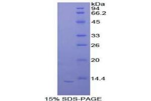 SDS-PAGE of Protein Standard from the Kit (Highly purified E. (IL-33 Kit CLIA)